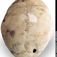  A woman skull certifying a successful cranial surgery that took place in the late 7th century BC